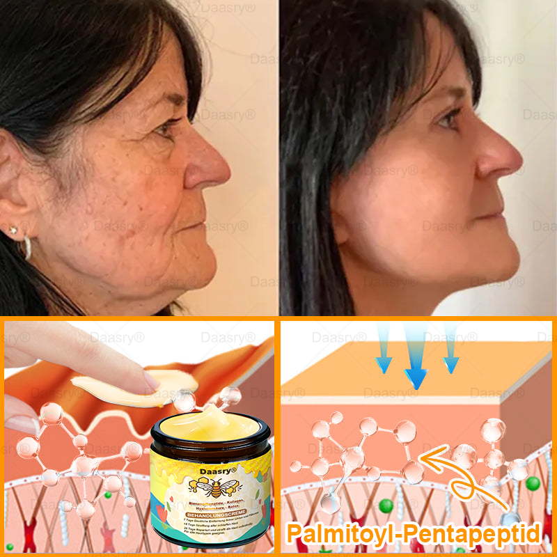🔥 🇩🇪Made & Shipped from Germany | Clinically Inspired: Daasry® Bee Venom Treatment Cream with bee venom peptides, hyaluronic acid, collagen, and triple peptides💧. Targets wrinkles, sagging, stretch marks, age spots—firms, lifts, and rejuvenates.