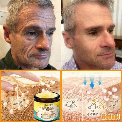 🔥 🇩🇪Made & Shipped from Germany | Clinically Inspired: Daasry® Bee Venom Treatment Cream with bee venom peptides, hyaluronic acid, collagen, and triple peptides💧. Targets wrinkles, sagging, stretch marks, age spots—firms, lifts, and rejuvenates.
