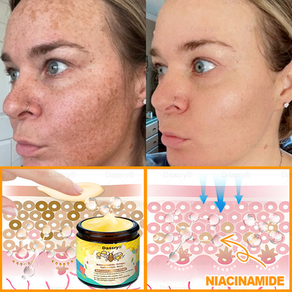 🔥 🇩🇪Made & Shipped from Germany | Clinically Inspired: Daasry® Bee Venom Treatment Cream with bee venom peptides, hyaluronic acid, collagen, and triple peptides💧. Targets wrinkles, sagging, stretch marks, age spots—firms, lifts, and rejuvenates.